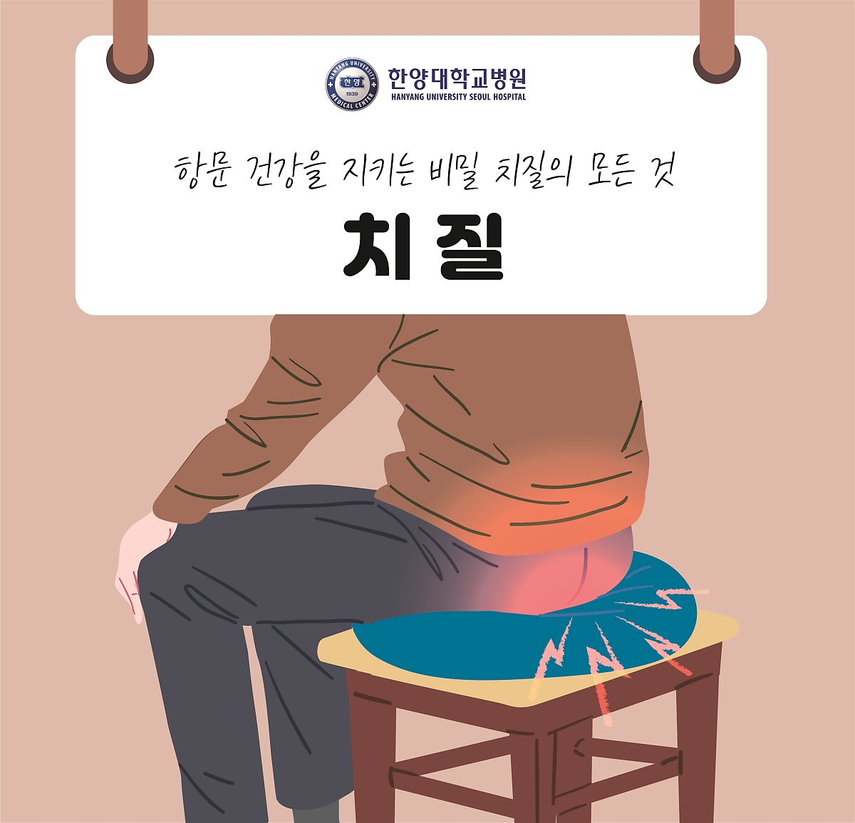항문 건강을 지키는 비밀 '치질'의 모든 것